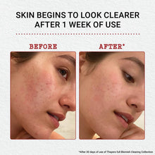 Load image into Gallery viewer, Witch Hazel Aloe Vera Astringent by Thayer&#39;s - Lemon